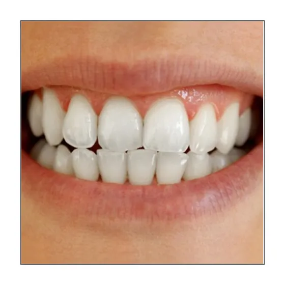 30534 oral hygiene tools