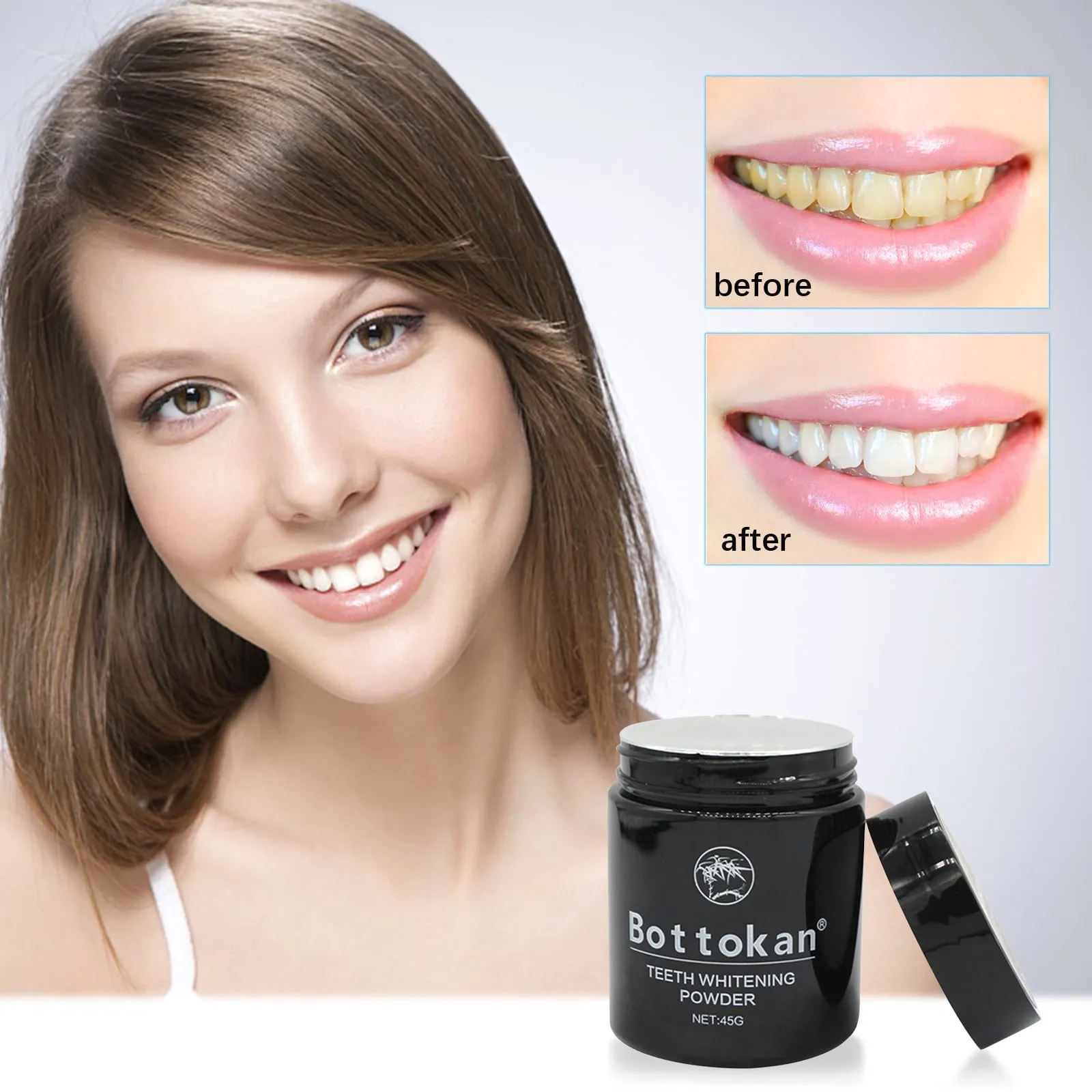 30534 teeth whitening before after