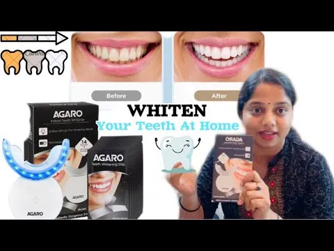 30534 teeth whitening diet