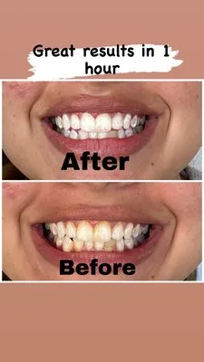 30537 whitening toothpaste