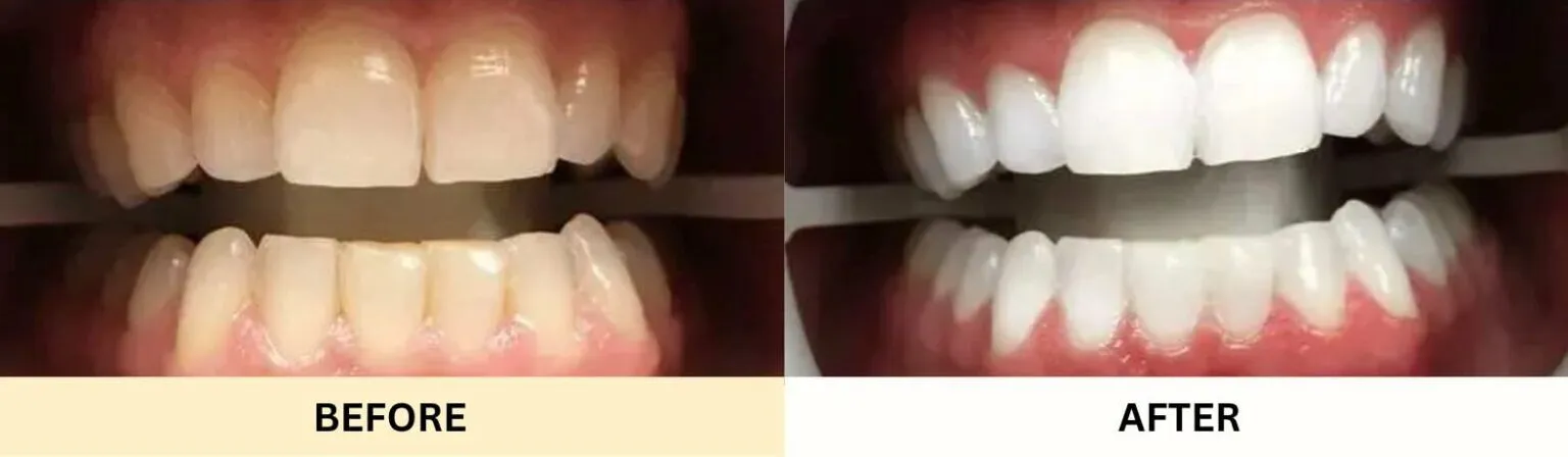 30538 dentist consultation