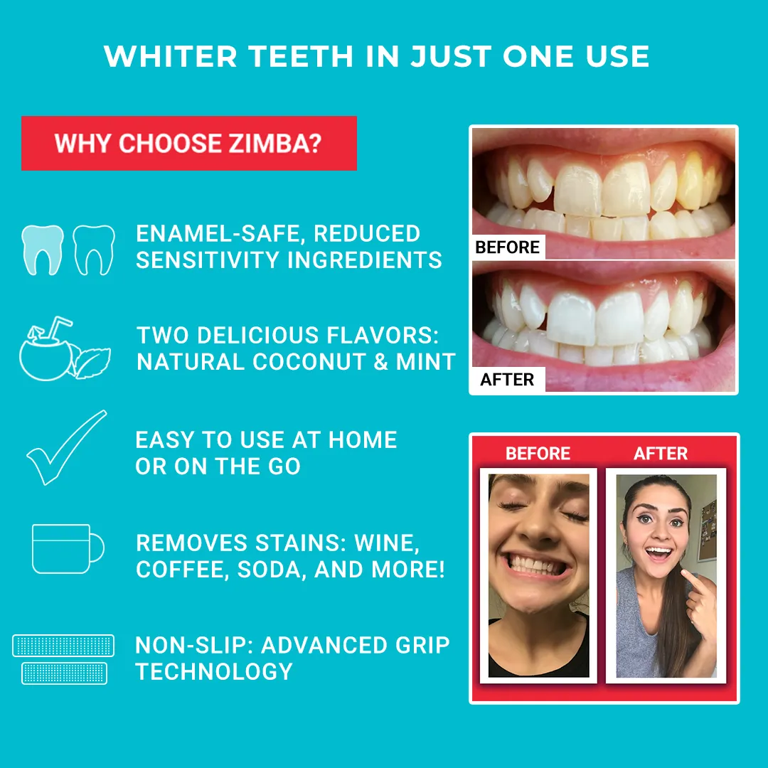 30542 teeth whitening before after