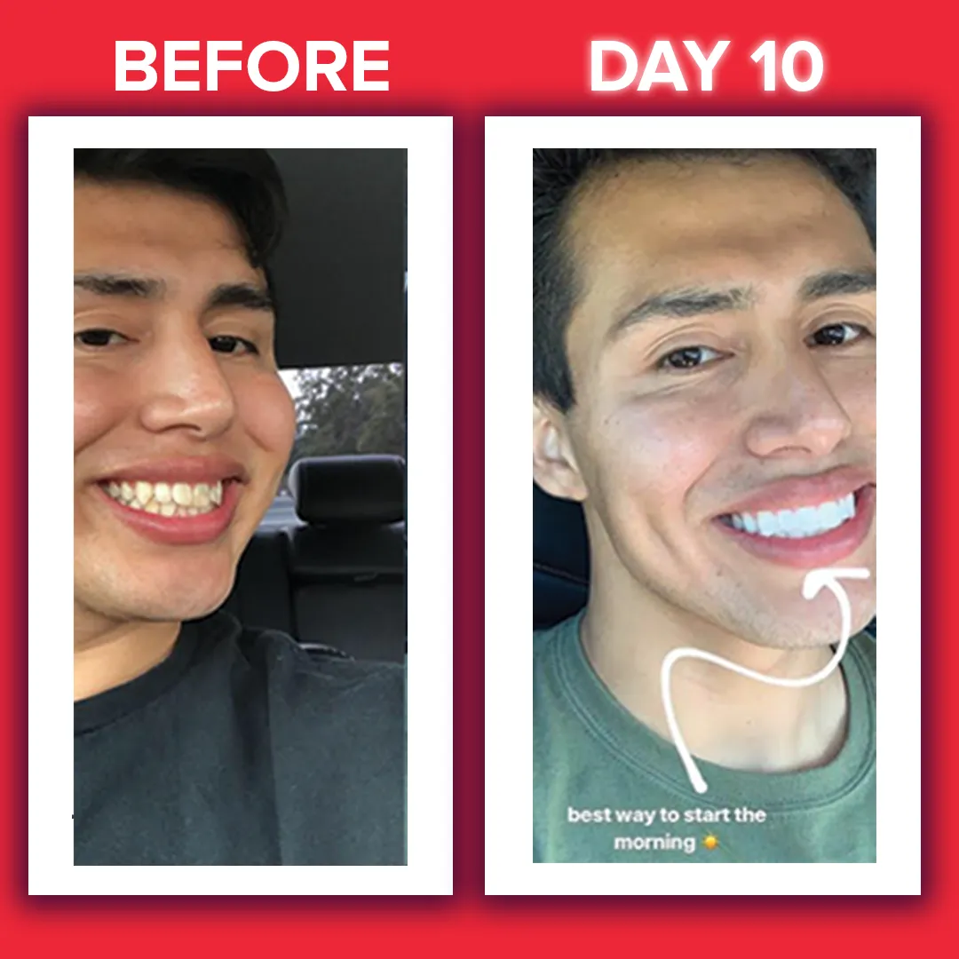 30542 zimba whitening ingredients