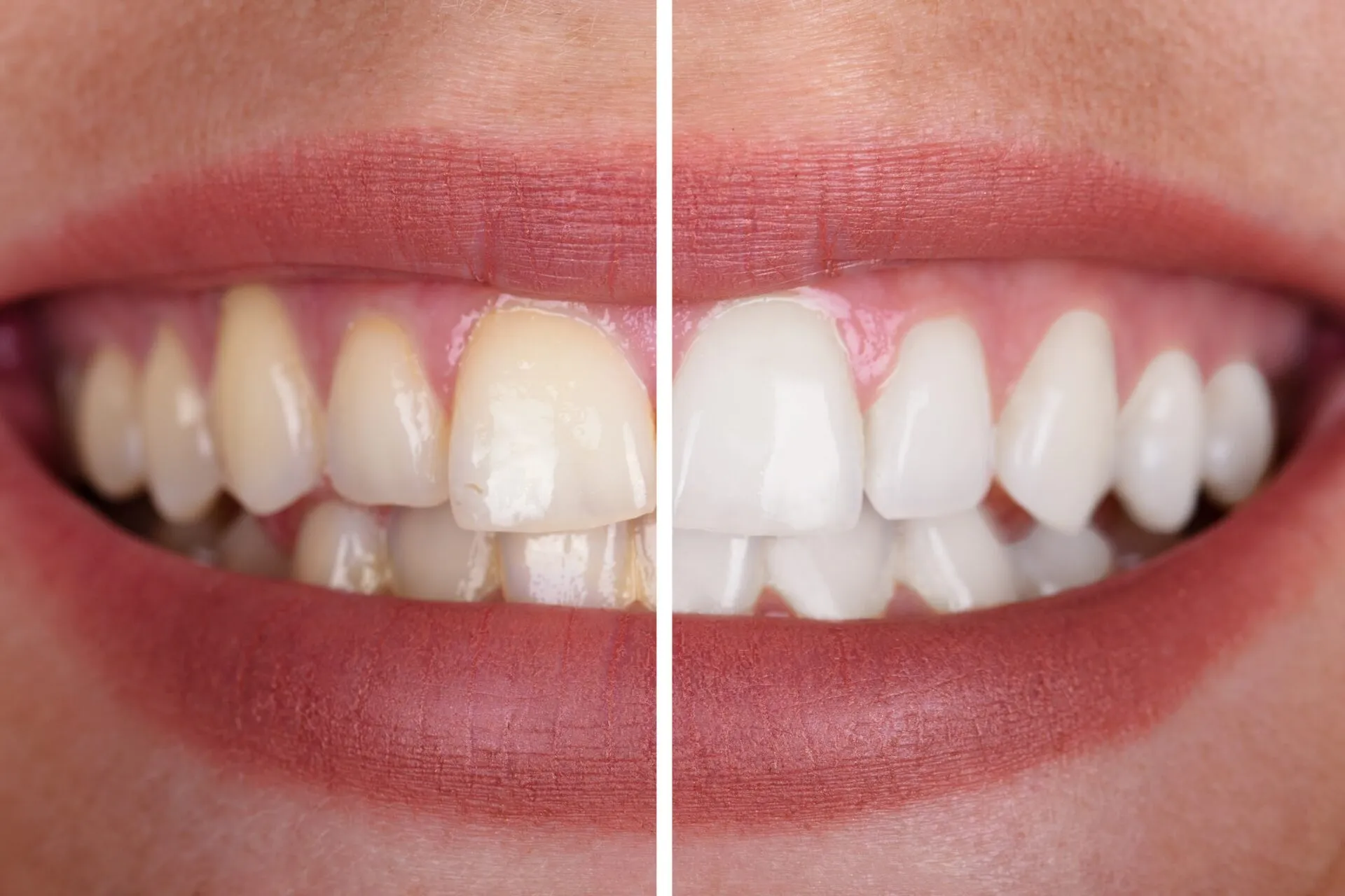 30543 whitening toothpaste