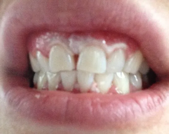 30546 professional whitening