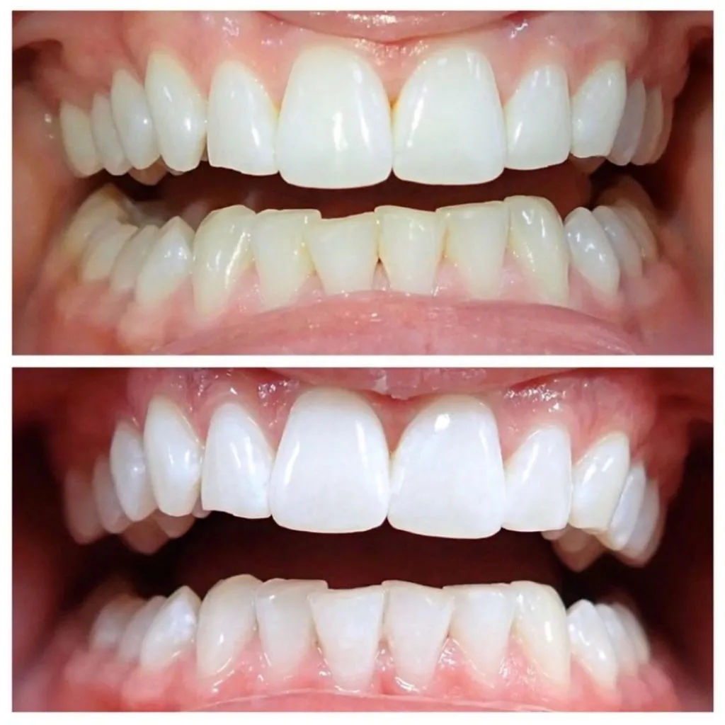 30548 brighton tooth whitening oral health