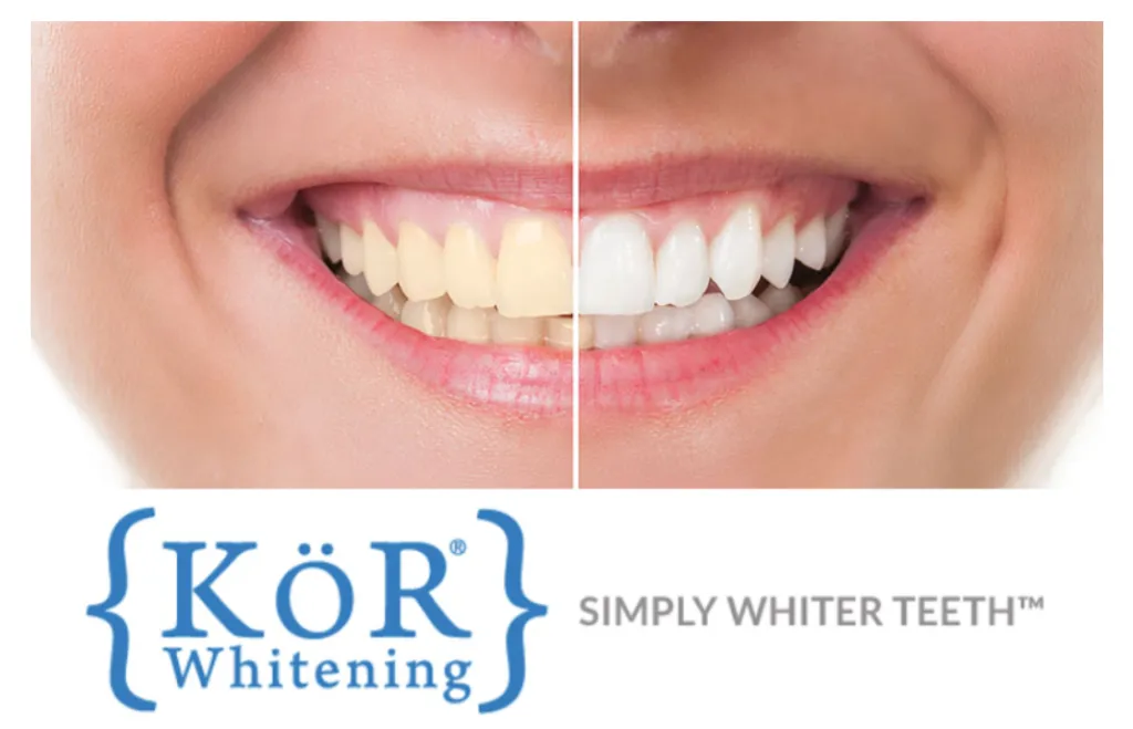 30549 teeth whitening schedule