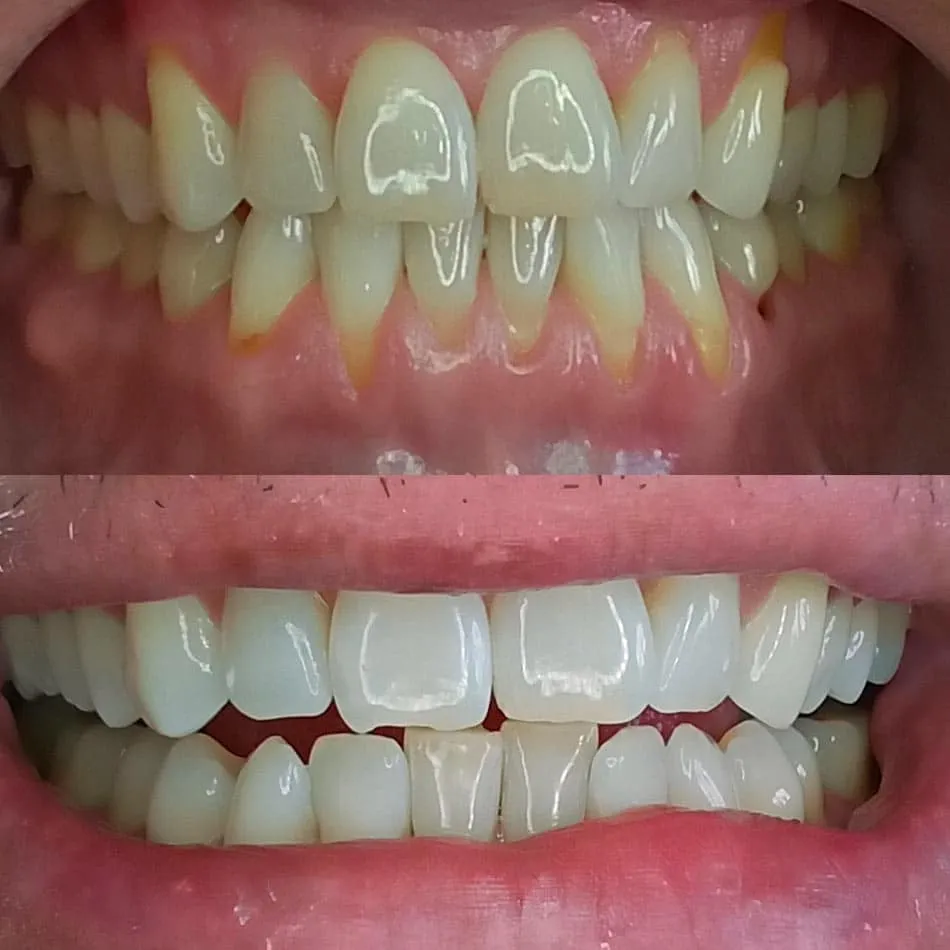 30550 abq dentist consultation