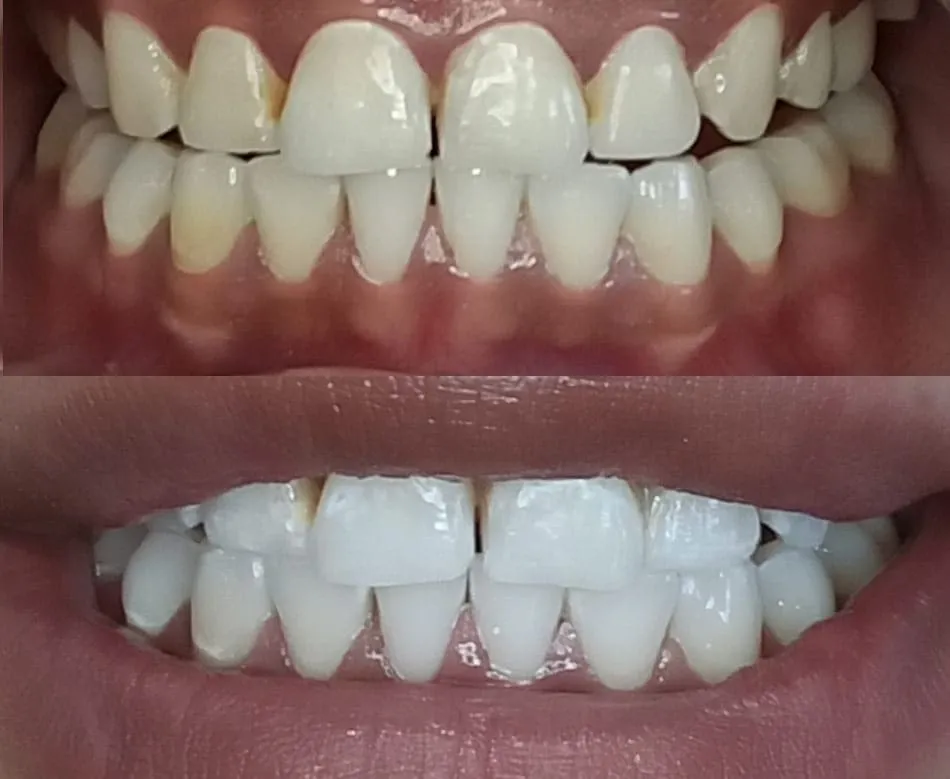 30550 smile maintenance abq