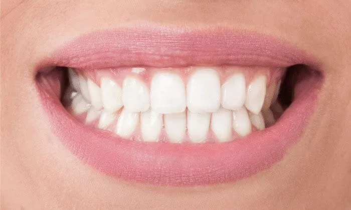 30554 teeth whitening brandon fl 4