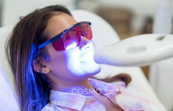 30556 affordable teeth whitening