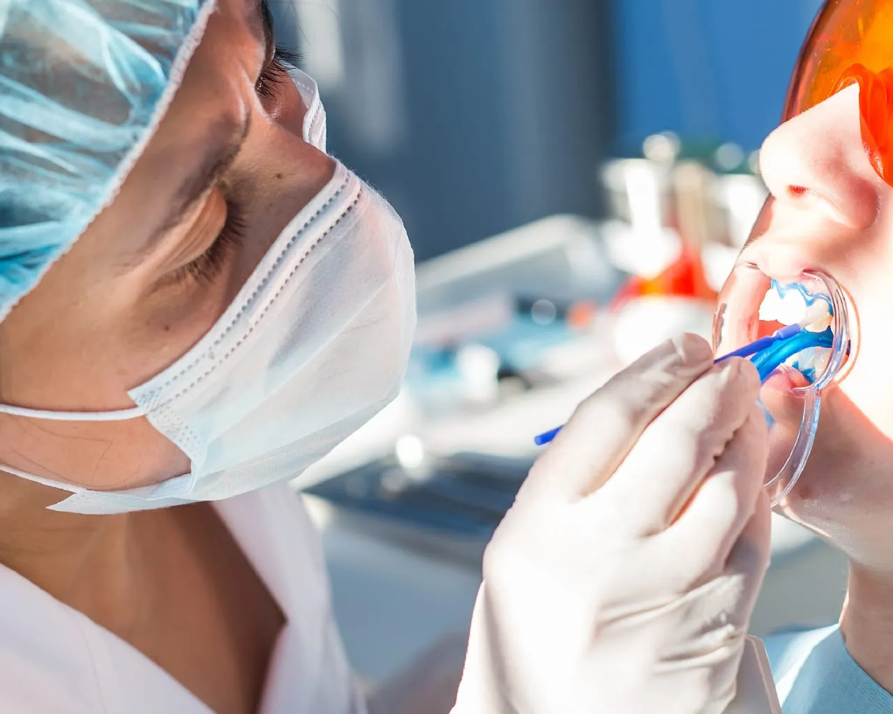 30556 at home teeth whitening