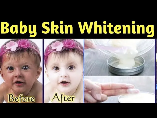 30558 newborn baby whitening image4
