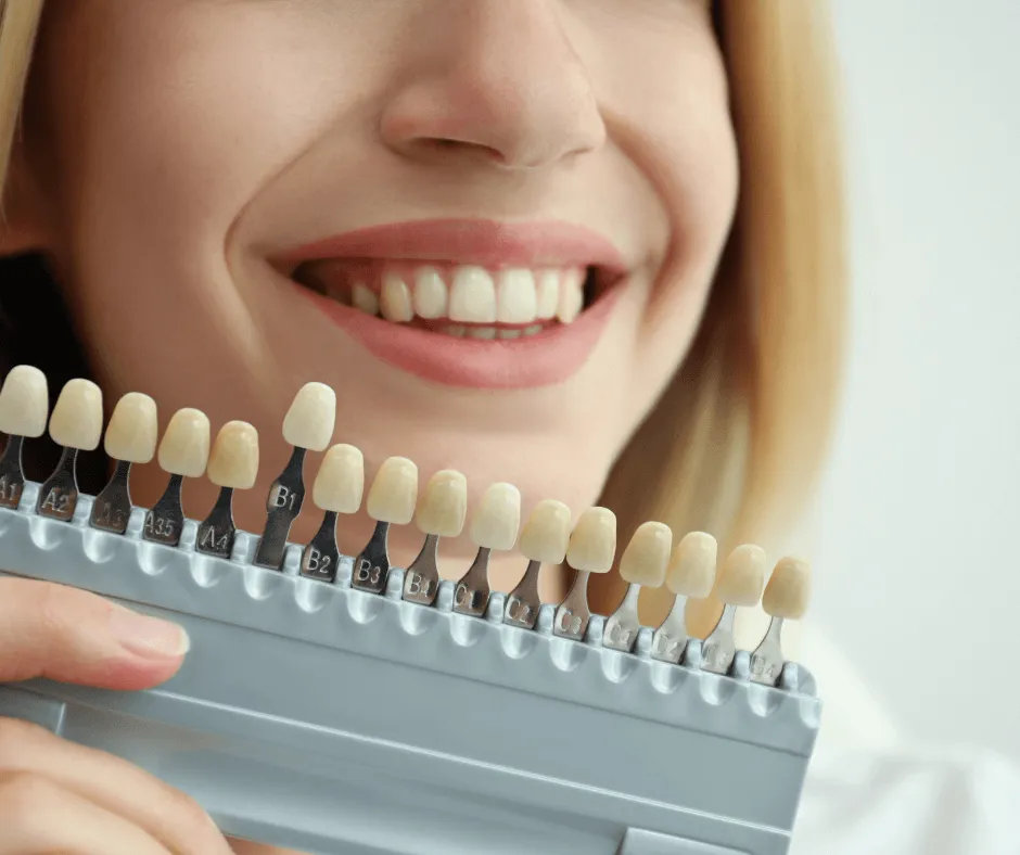 30563 teeth whitening comparison
