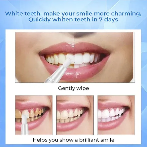 30574 teeth whitening pen pakistan results