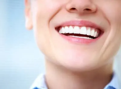30579 teeth whitening des moines 4