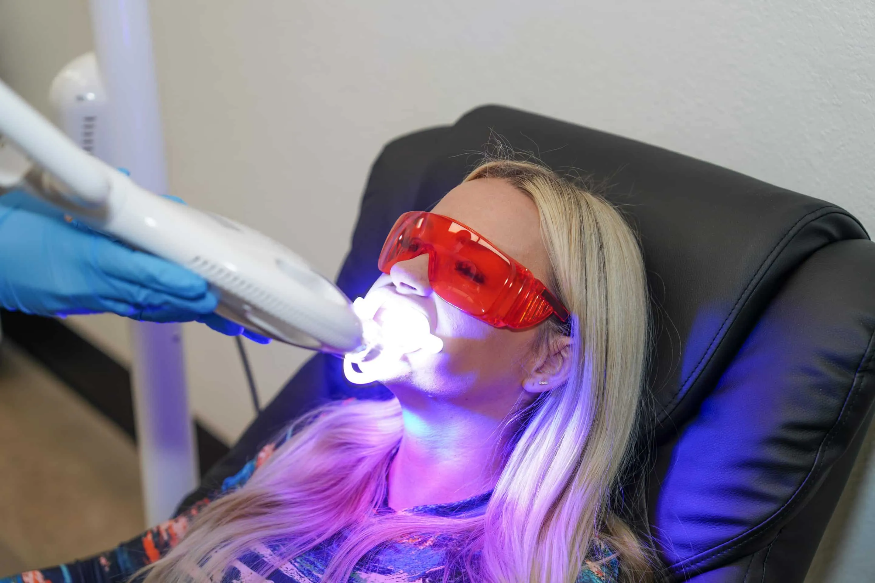 30580 utah teeth whitening image1