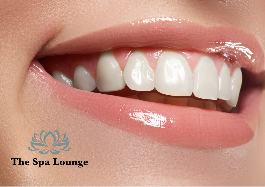 30580 utah teeth whitening image6