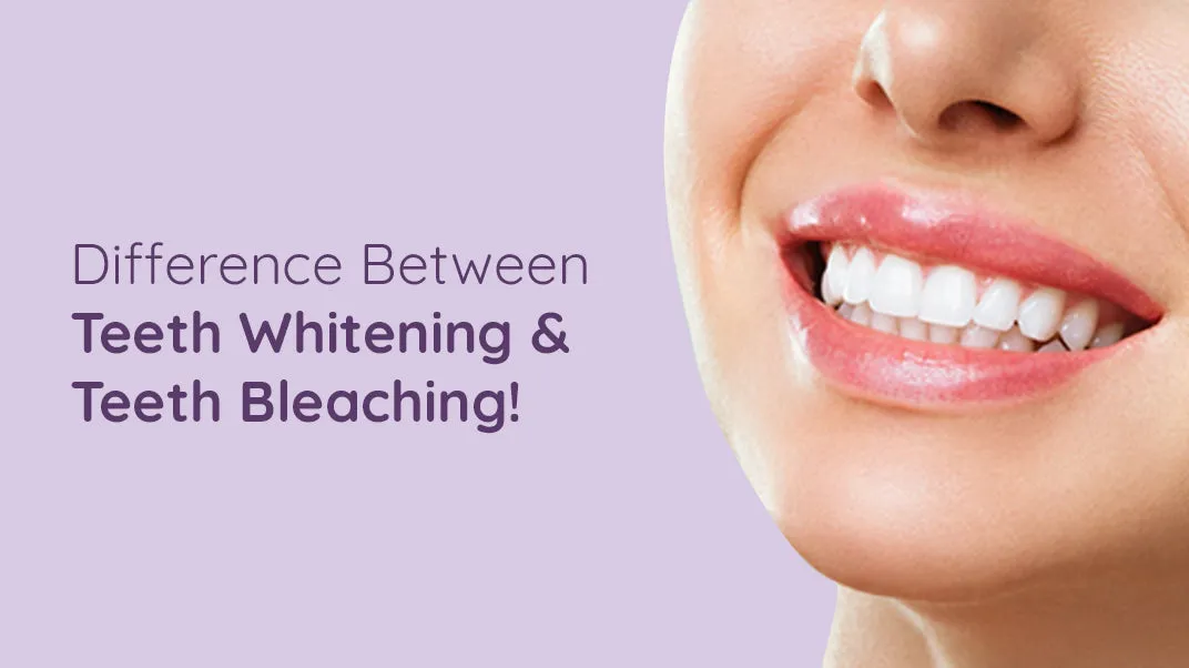 30585 over the counter whitening