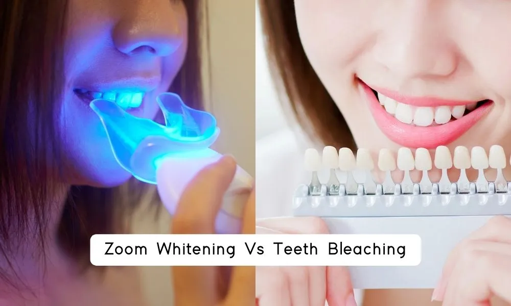 30585 teeth bleaching results