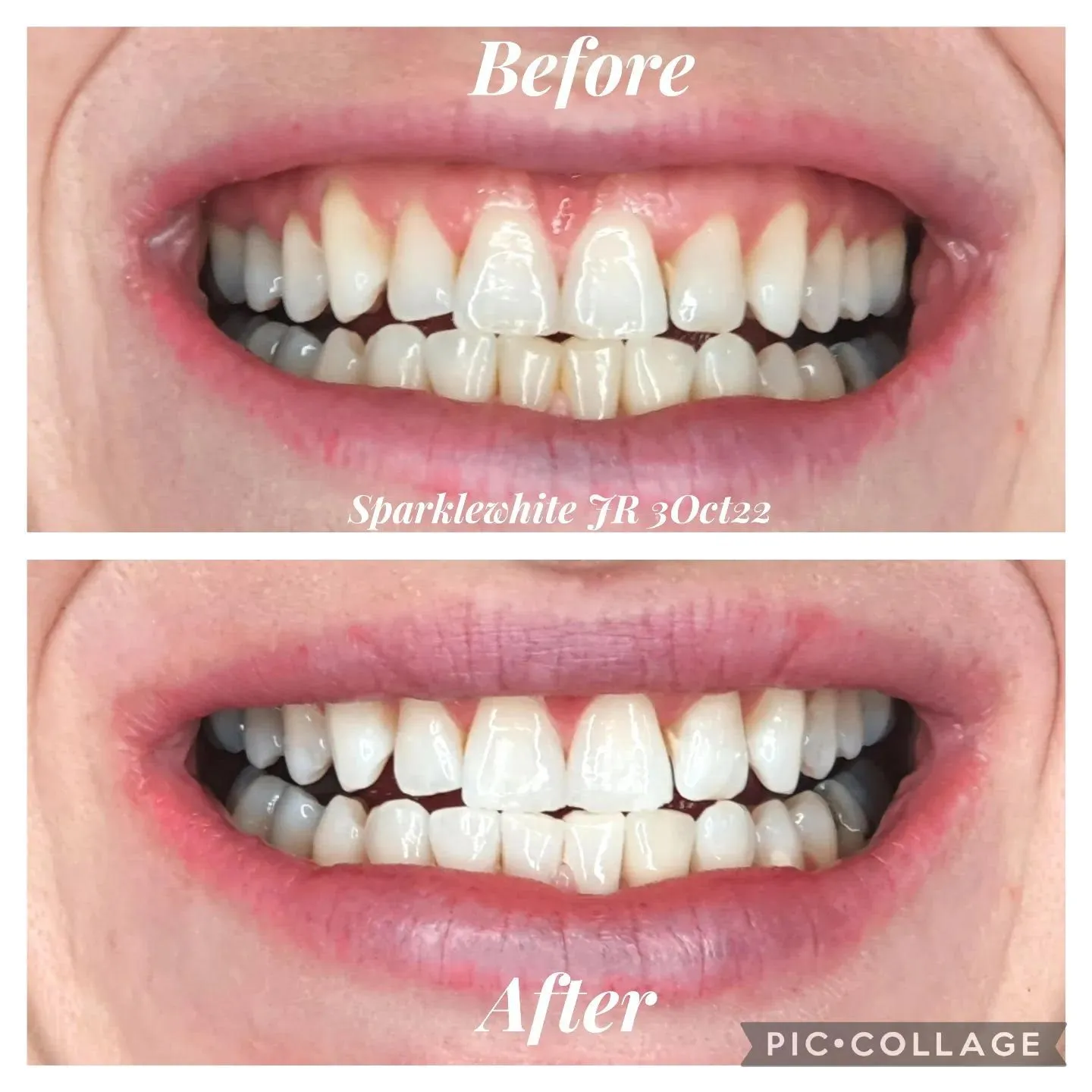 30589 teeth whitening company 2