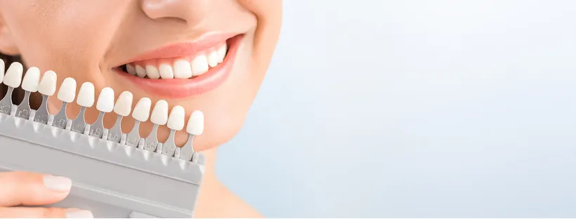 /img/30589-teeth-whitening-company-3.webp