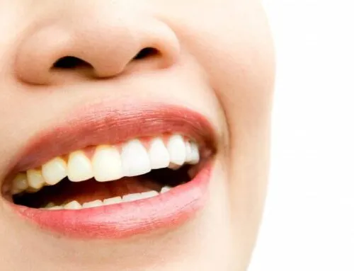 30590 teeth whitening massapequa image4