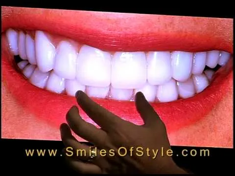 /img/30590-teeth-whitening-massapequa-image7.webp