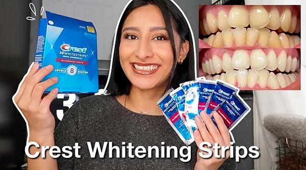 30591 teeth whitening process