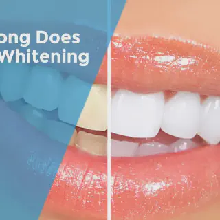 /img/30591-whitening-toothpaste.webp