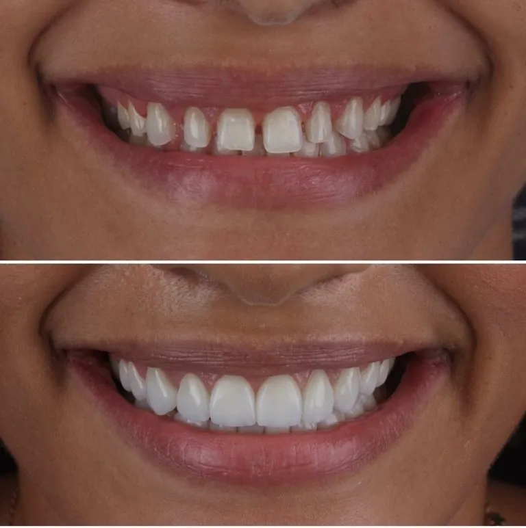 30592 oral hygiene practices