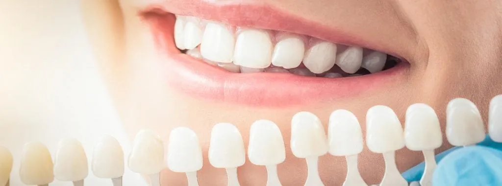 30592 take home whitening kits