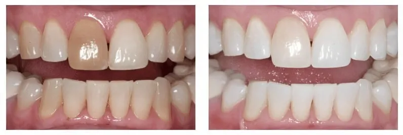 30595 milwaukee dentist consultation