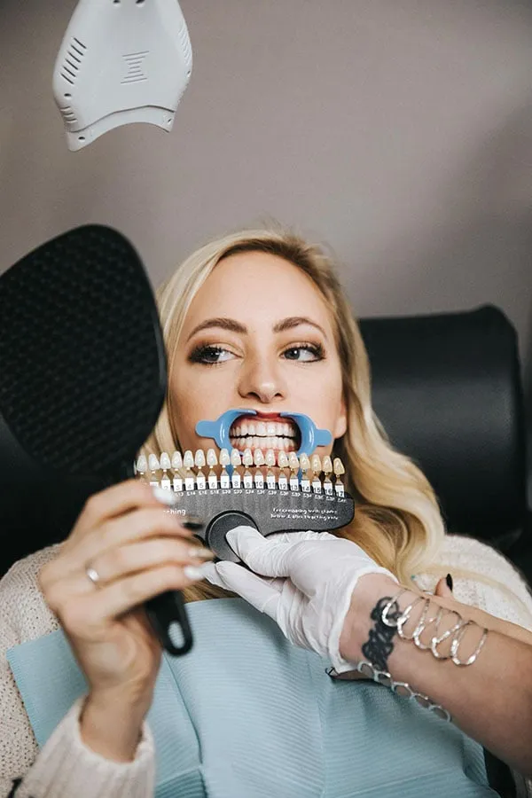 30598 personalized teeth whitening