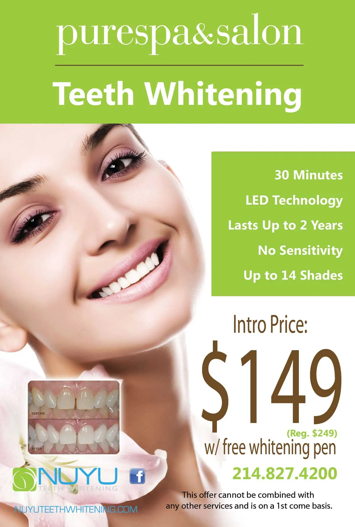 /img/30599-teeth-whitening-party-aftercare.webp