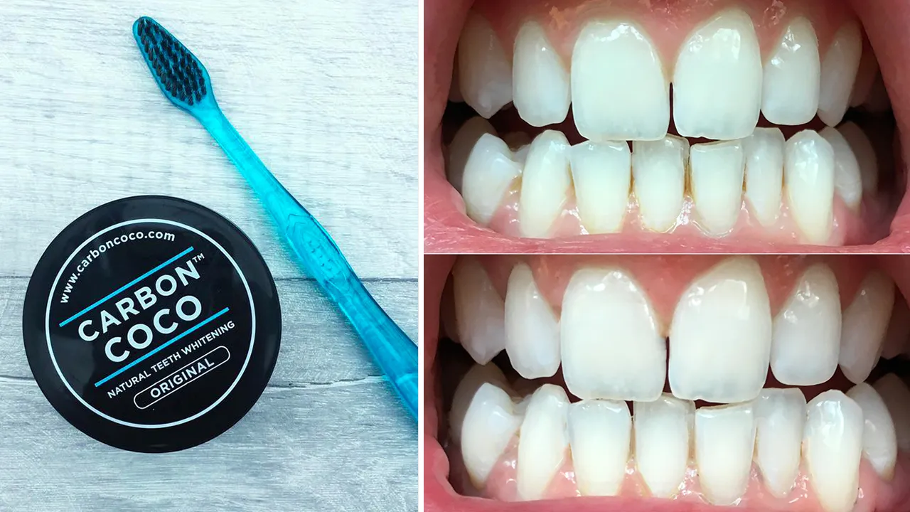 30611 teeth whitening routine