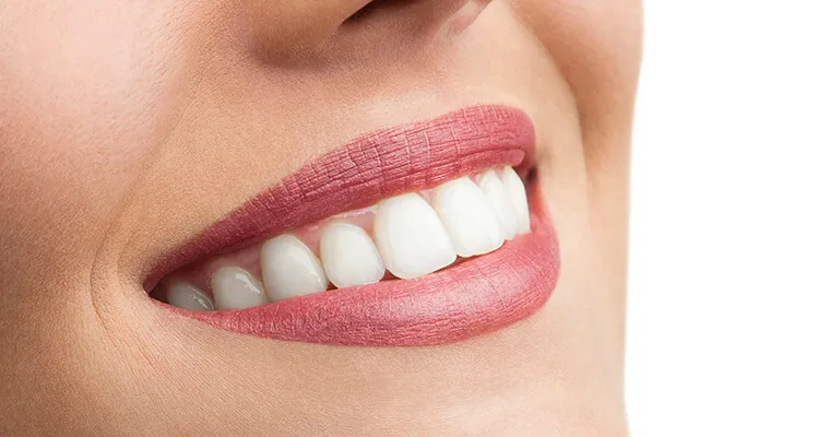 30616 teeth whitening woburn confidence