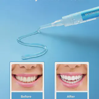 /img/30617-teeth-whitening-results.webp