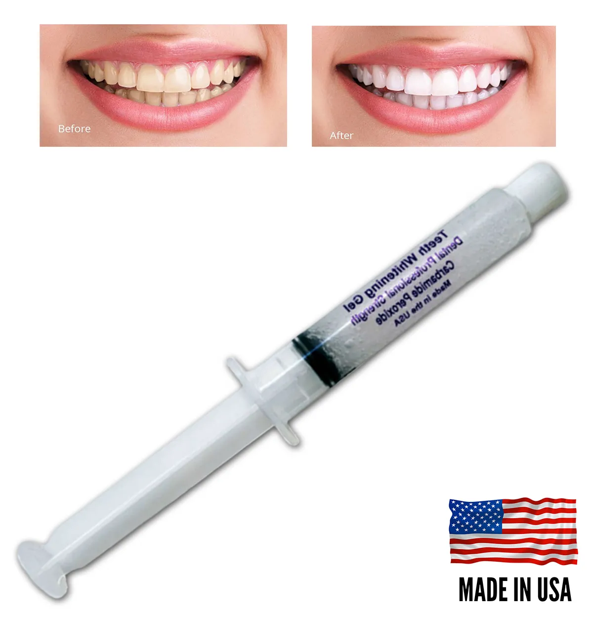 30617 types of teeth whitening syringes