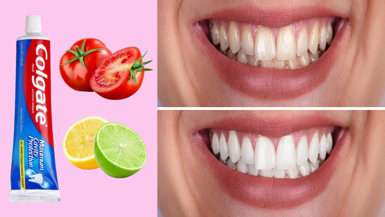 30621 oral hygiene routine