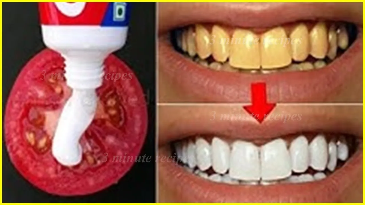 30621 tomato teeth whitening application
