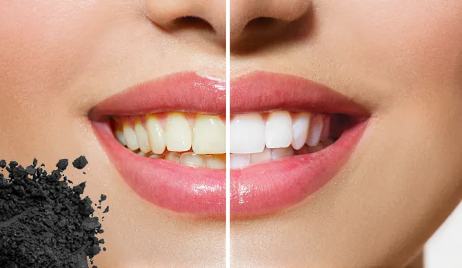 30623 charcoal teeth whitening 2