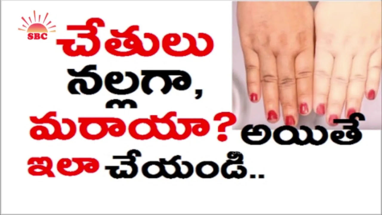 30624 hands whitening before after