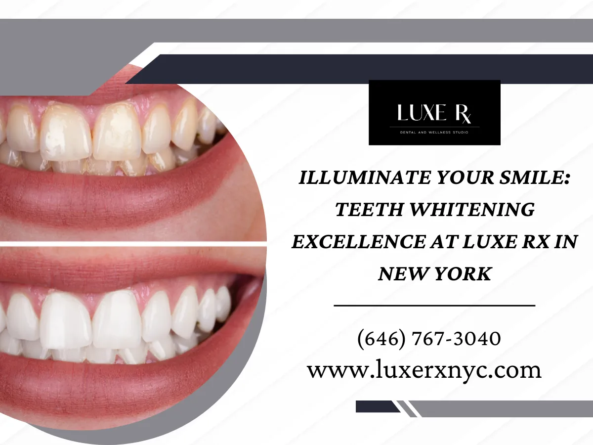 30626 luxe smile before after