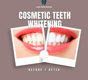 30626 teeth whitening care