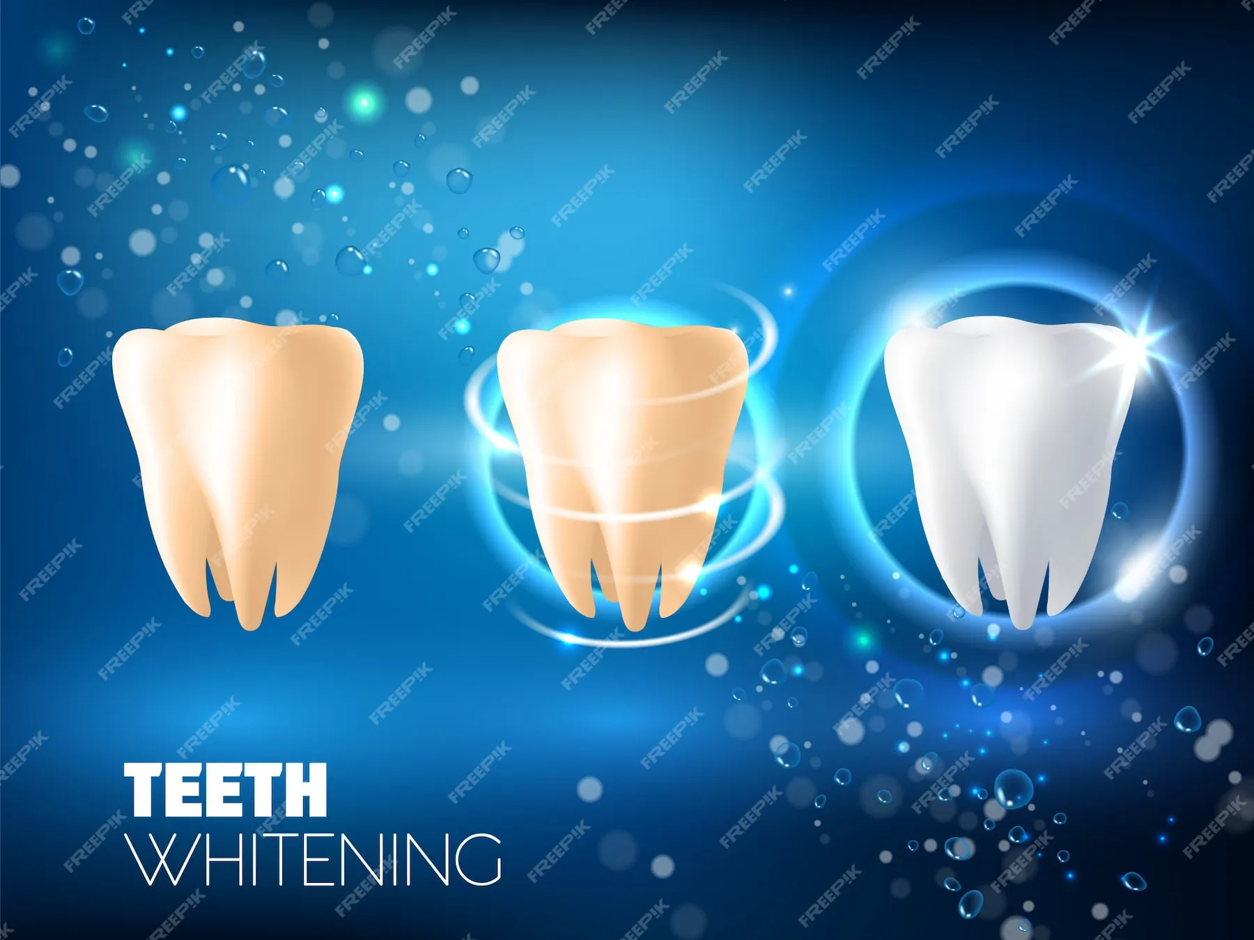 30630 teeth whitening smile vector
