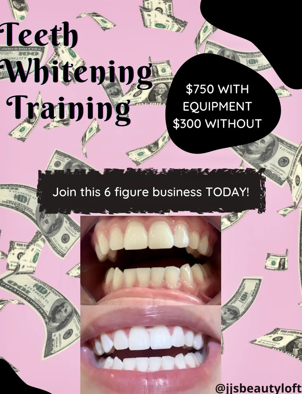 30631 mobile teeth whitening equipment