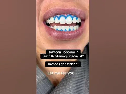 30631 mobile teeth whitening service