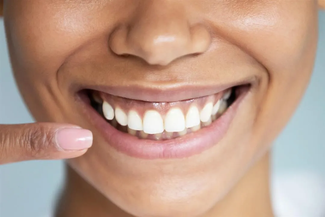 30632 teeth whitening deals