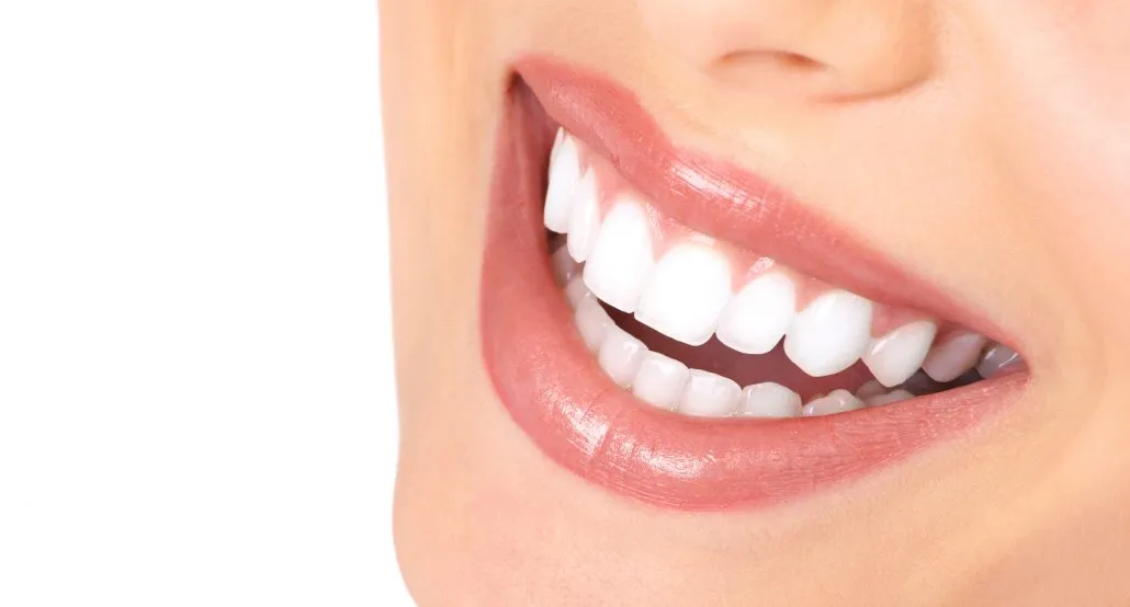 30633 teeth whitening lexington ky image5